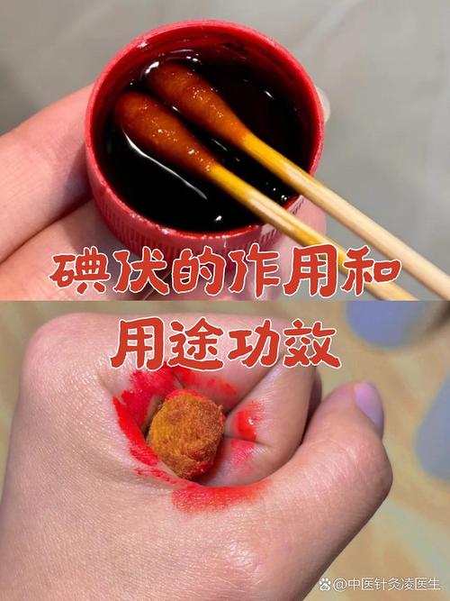 碘伏是一種含有碘的消毒劑,很多人家中常備